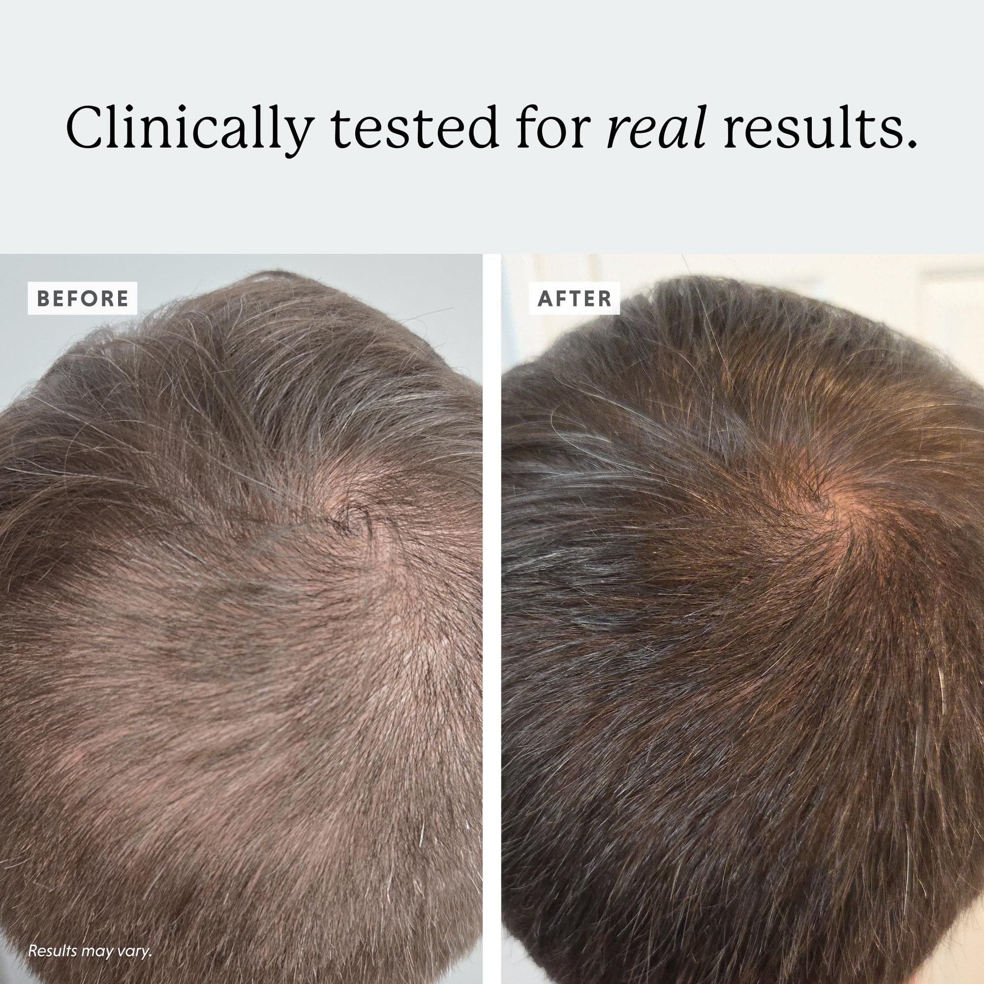 Colorsmith Densifying Scalp Serum label highlights Procapil and Redensyl ingredients
