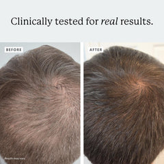 Colorsmith Densifying Scalp Serum label highlights Procapil and Redensyl ingredients