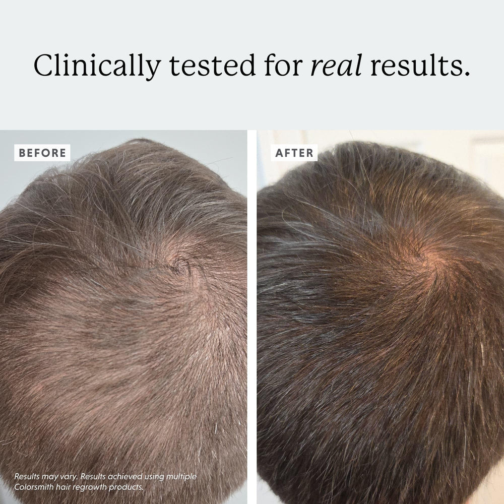 Colorsmith bottle targeting scalp application on thinning areas