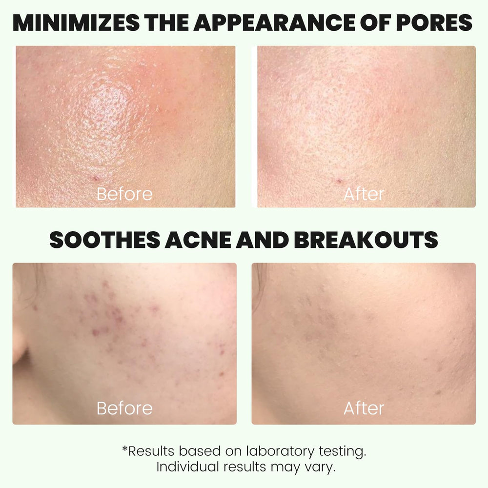 ConfidMiss green alaska volcano clay stick detoxifies pores and tightens oily skin.