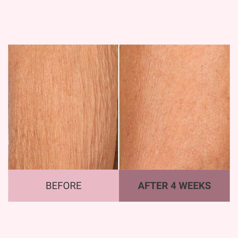 Consult Beaute grape stem cells visual suggesting improved firmness and vitality.