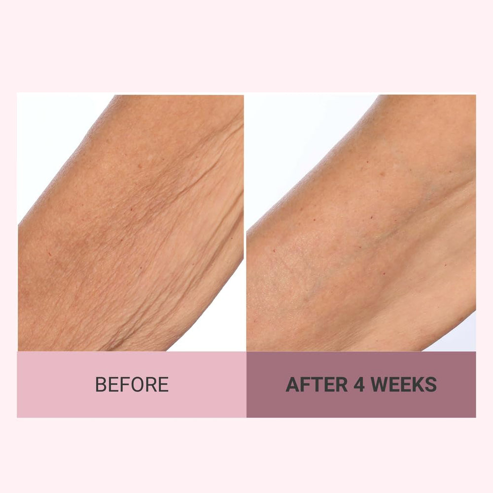 Consult Beaute Champagne Lift on dry areas offering intense hydration.