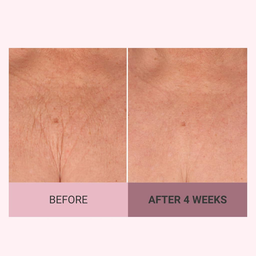 Consult Beaute Pink PepperSlim effect on the skin boosting microcirculation.