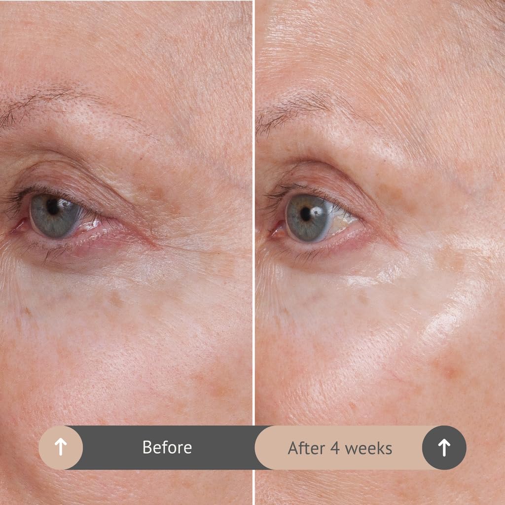 Volumagen Trio marine spheres visible to plump and smooth texture