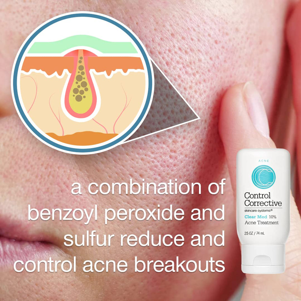 Control Corrective Clear Med label highlights benzoyl peroxide and sulfur actives