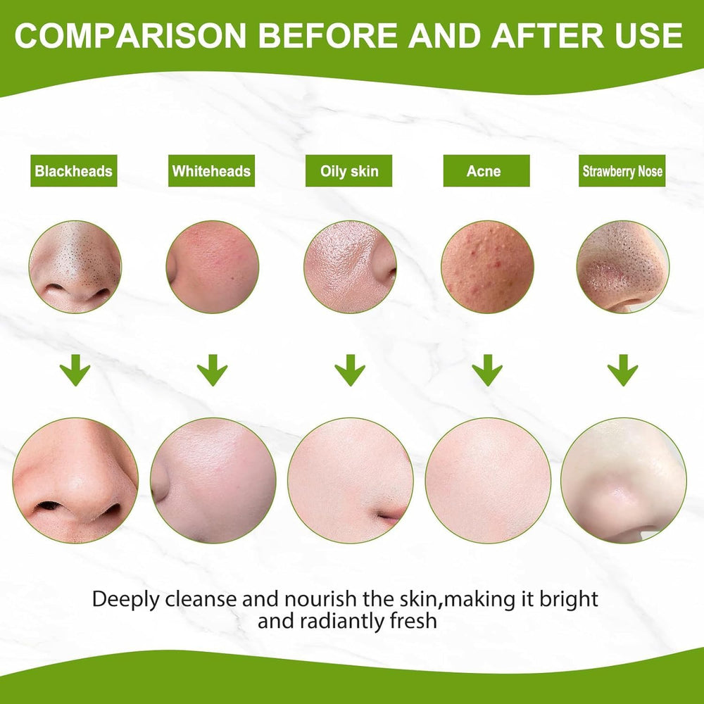 Coperalcool Oil-balancing mask reduces shine during daily use