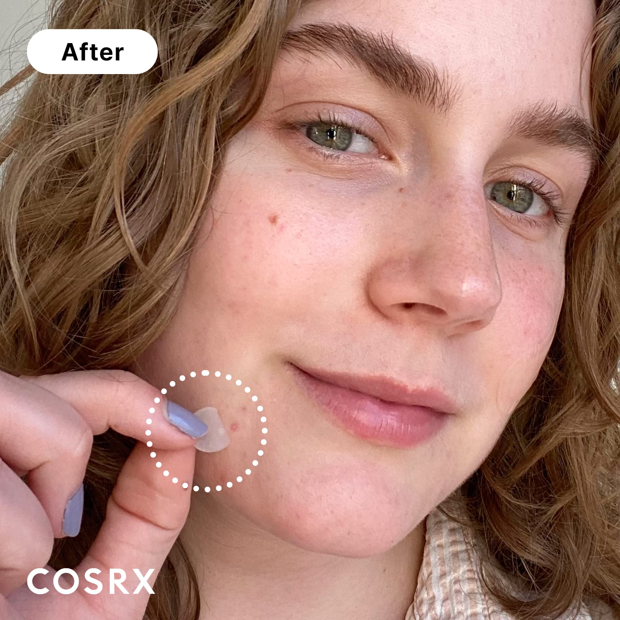 COSRX three sizes patch pack showing S, M, L options for spots