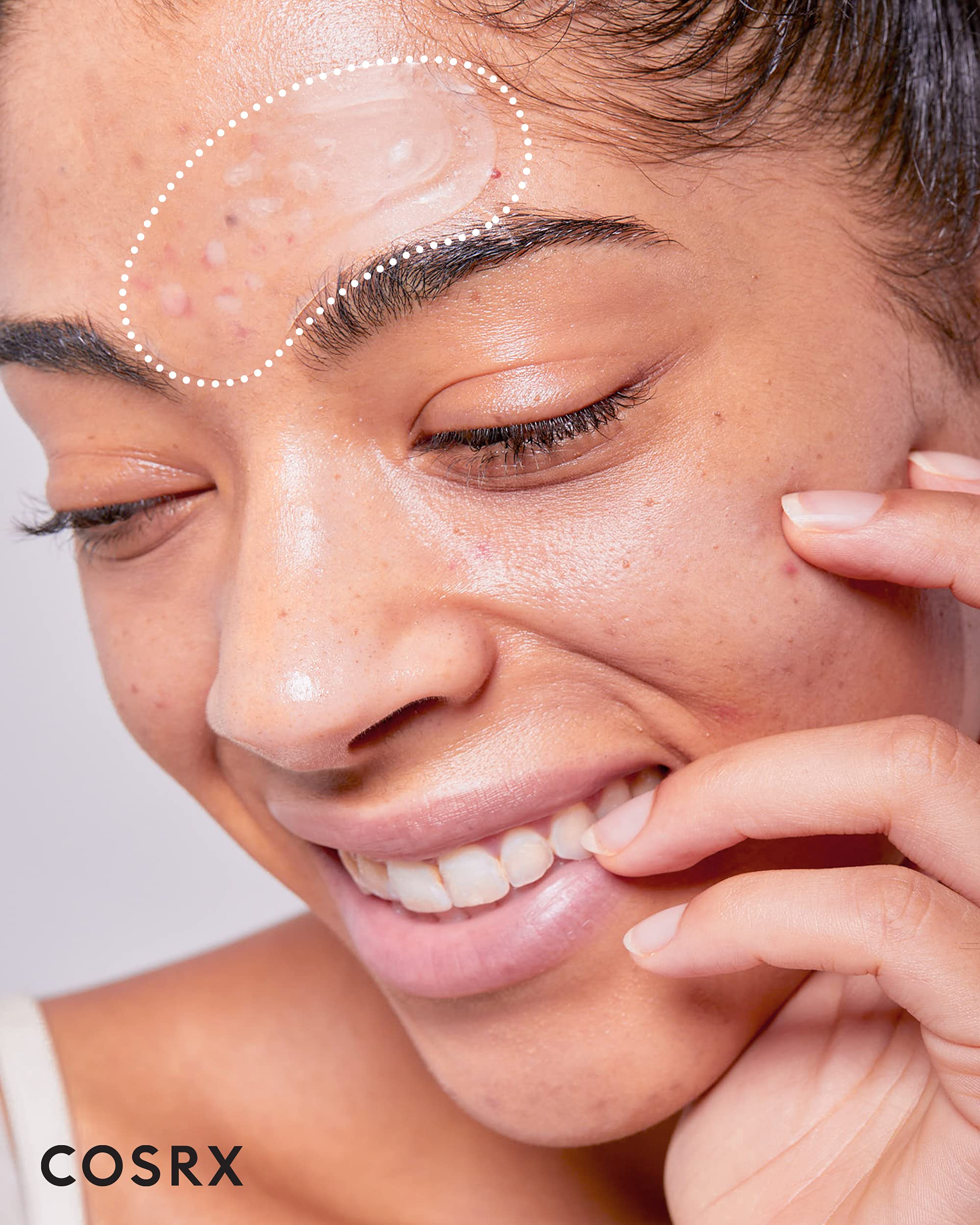 COSRX Master Patch Intensive being applied to blemish for targeted treatment