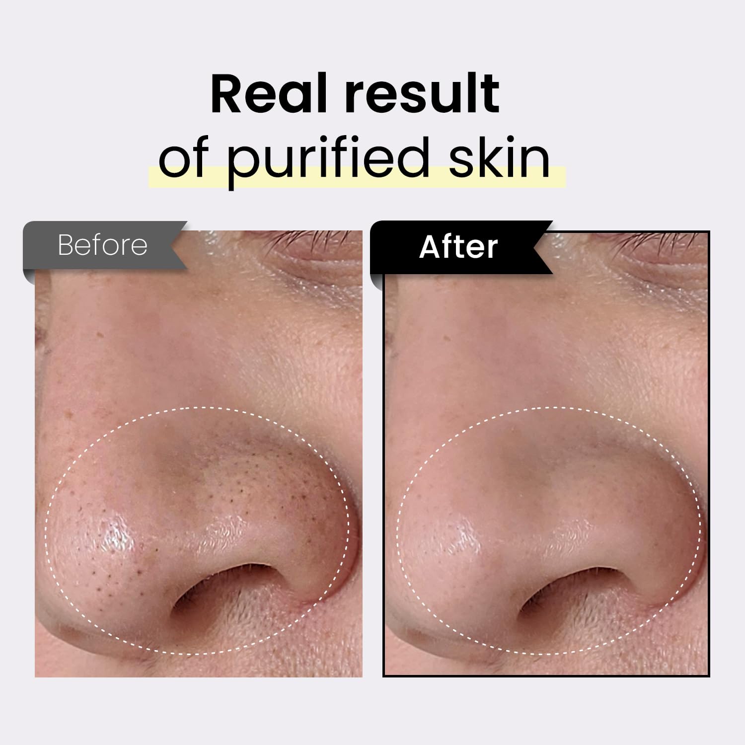 Coxir TXA Black Rice Pore Mask closeup texture shows soft gel for refreshing skin.