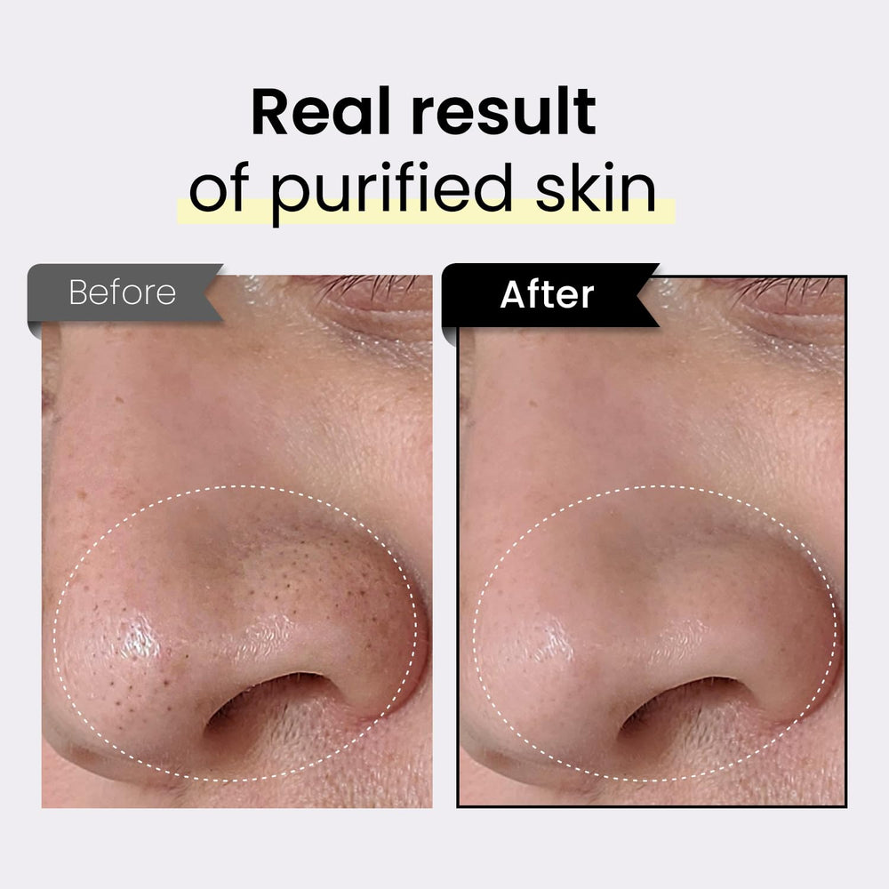 Coxir TXA Black Rice Pore Mask closeup texture shows soft gel for refreshing skin.