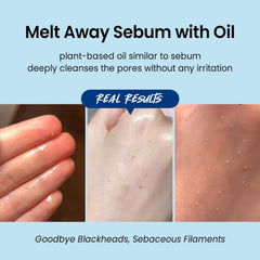Coxir Ultra Hyaluronic Cleansing Oil provides deep moisture for plump hydrated skin
