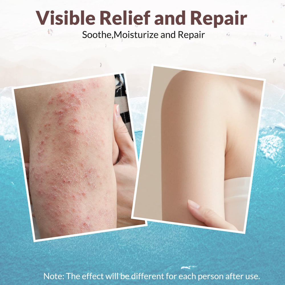 Crogooe eczema cream application on skin demonstrating quick absorption.