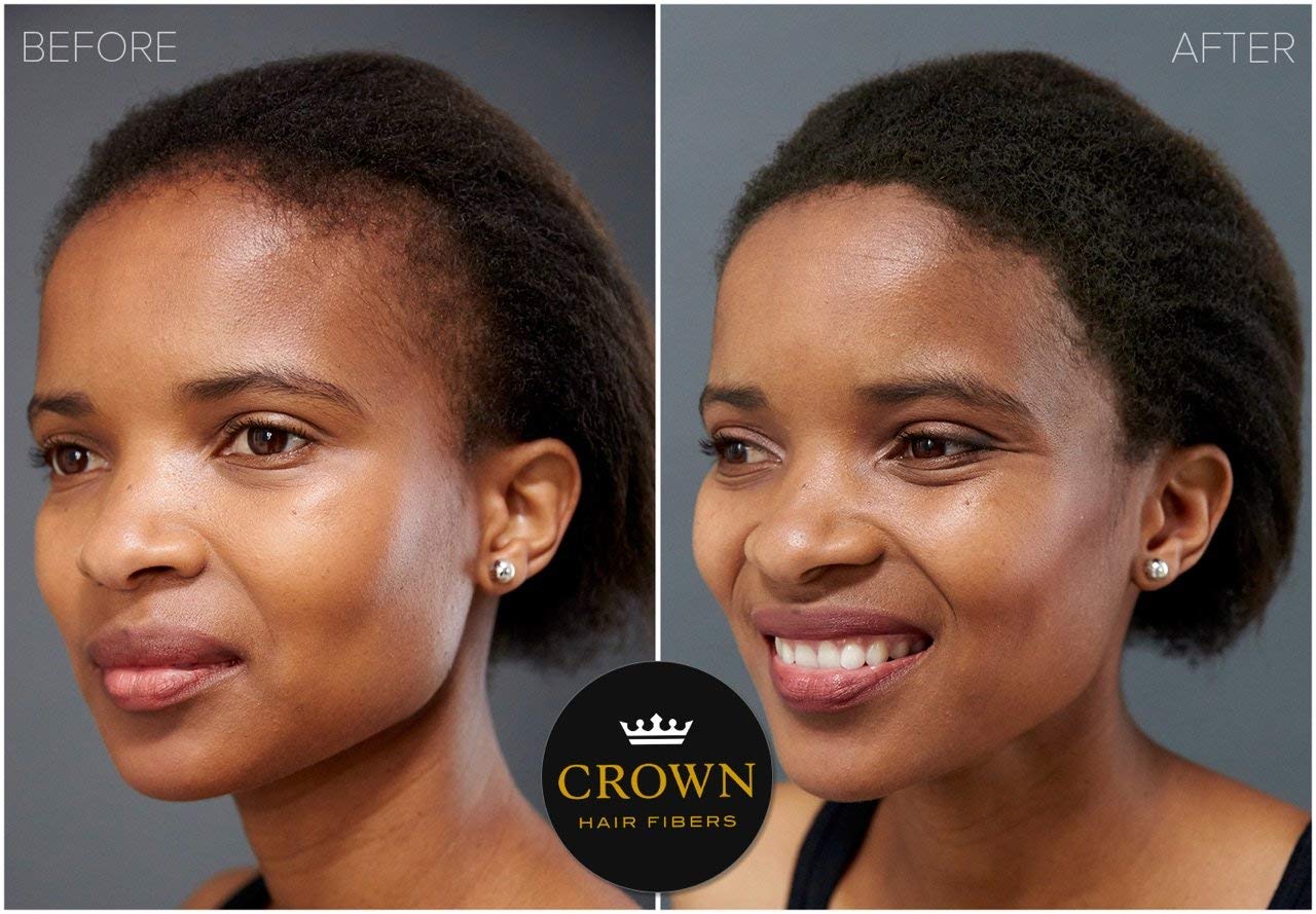 Fiber powder application from Crown Twenty1 creating an even scalp appearance.