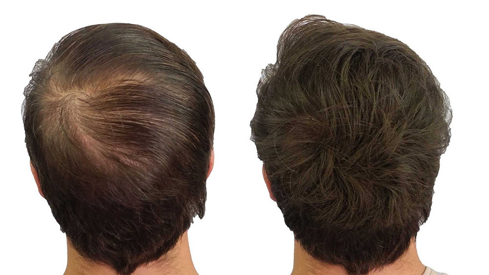 CROWN Twenty1 fibers applied to thinning areas for instant coverage.