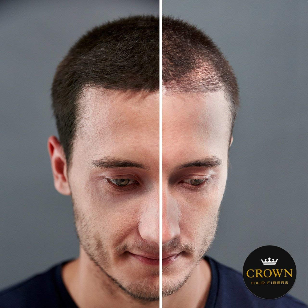 Close-up of Crown Twenty1 keratin concealer bottle for discreet use.