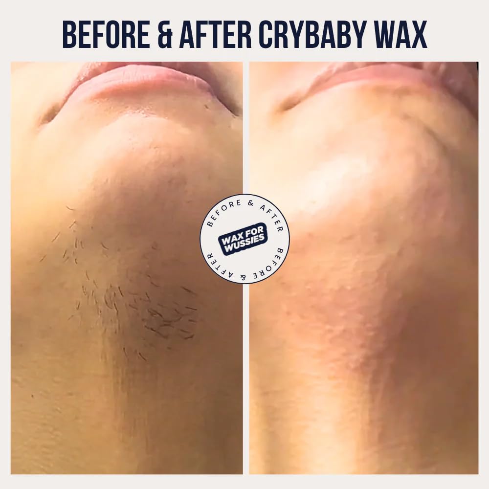 Crybaby Wax PCOS facial-hair removal targets root hairs with care.