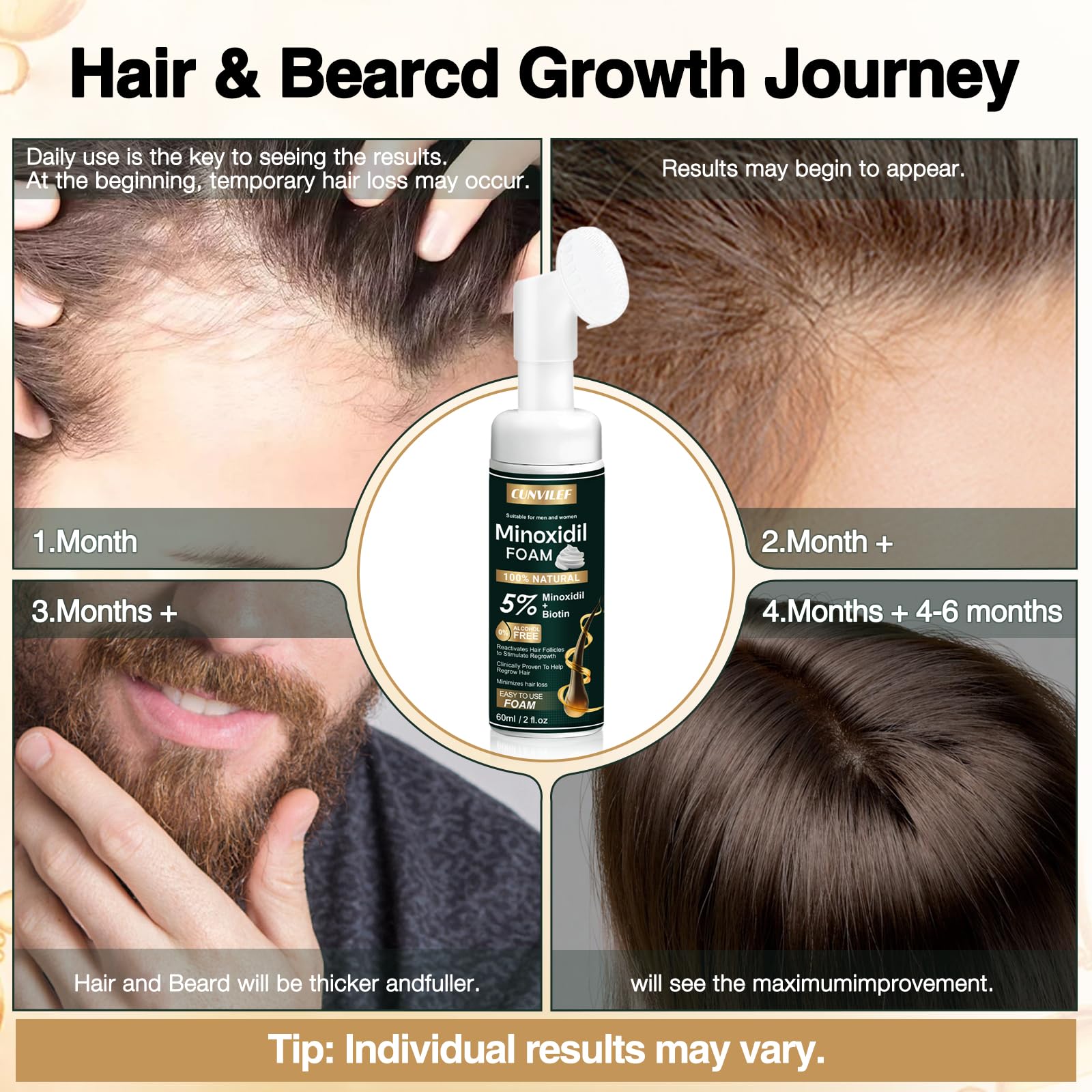 CUNVILEF Minoxidil Foam no-rinse design allows quick daily use.