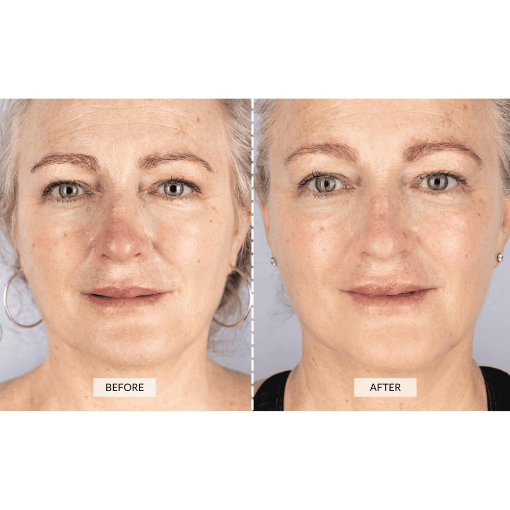 CurrentBody Skin LED Mask delivers red 633nm light for surface exposure