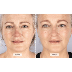 CurrentBody Skin LED Mask delivers red 633nm light for surface exposure