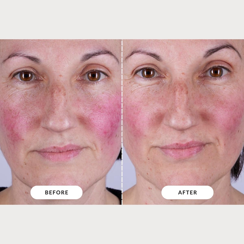 CurrentBody Skin LED Mask Series 2 in use for at-home spa wellness.