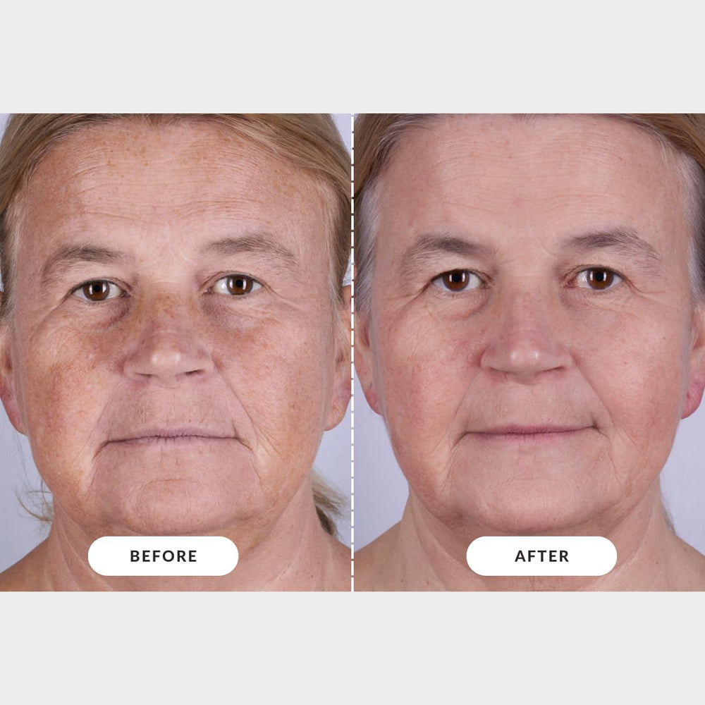 CurrentBody Skin LED Light Therapy Mask Series 2 | At-Home Rejuvenatio ...