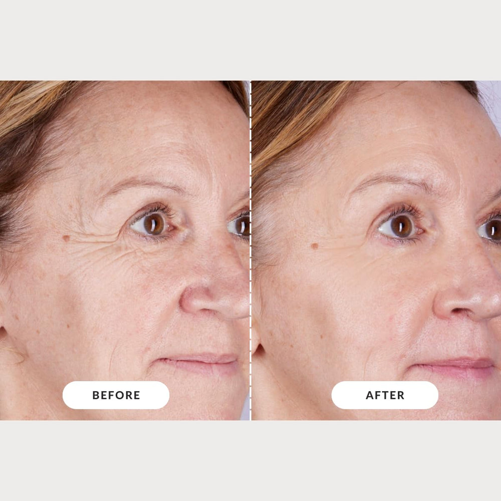 CurrentBody Skin LED Light Therapy Mask Series 2 | At-Home Rejuvenatio ...