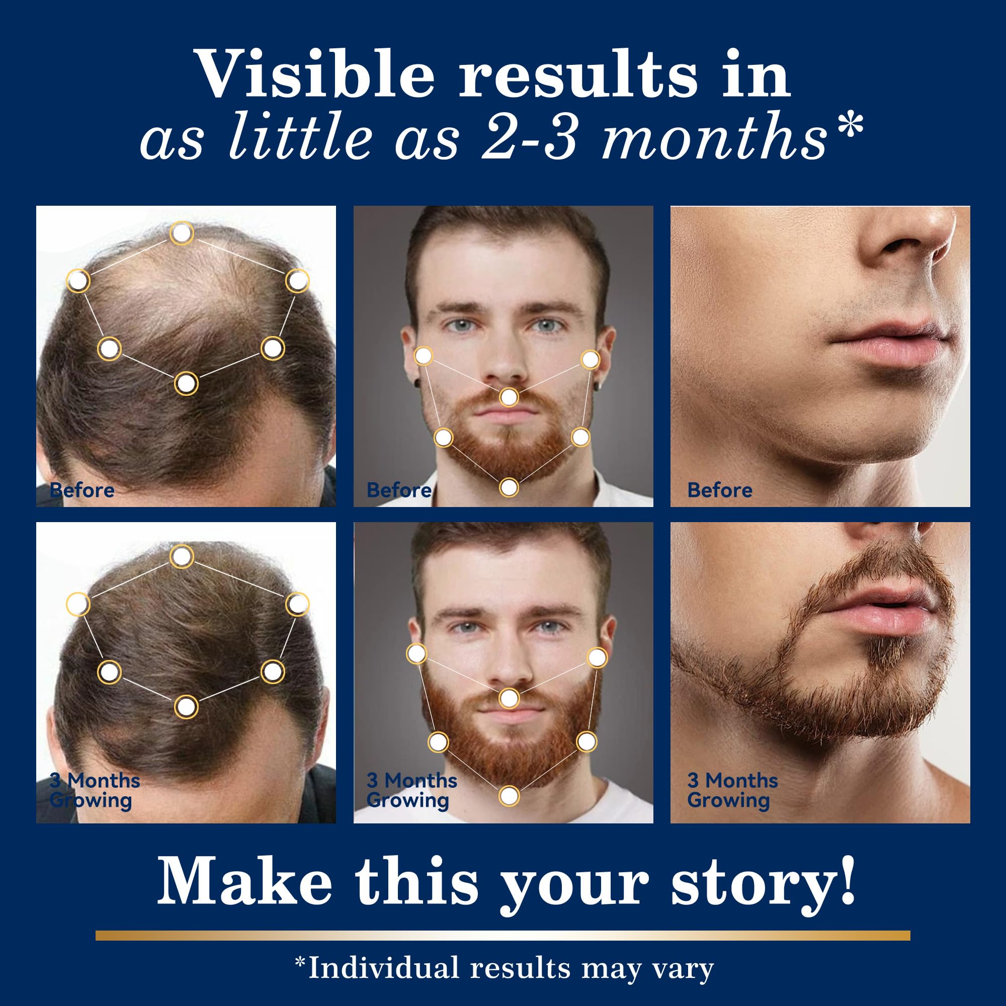 DAAZZS minoxidil biotin niacinamide closeup highlighting nourishing support