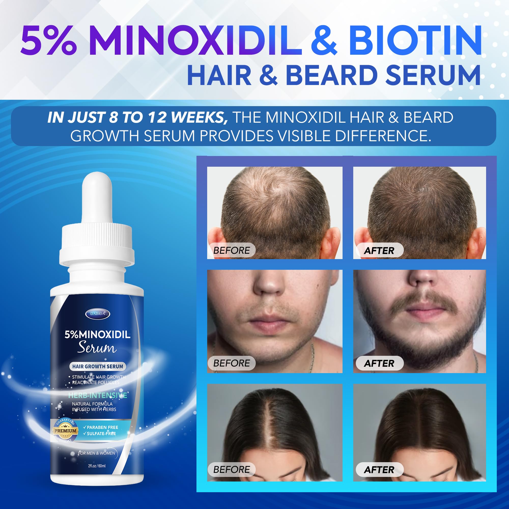 DABIDA minoxidil dropper application demonstrates precise dosing for problem areas.