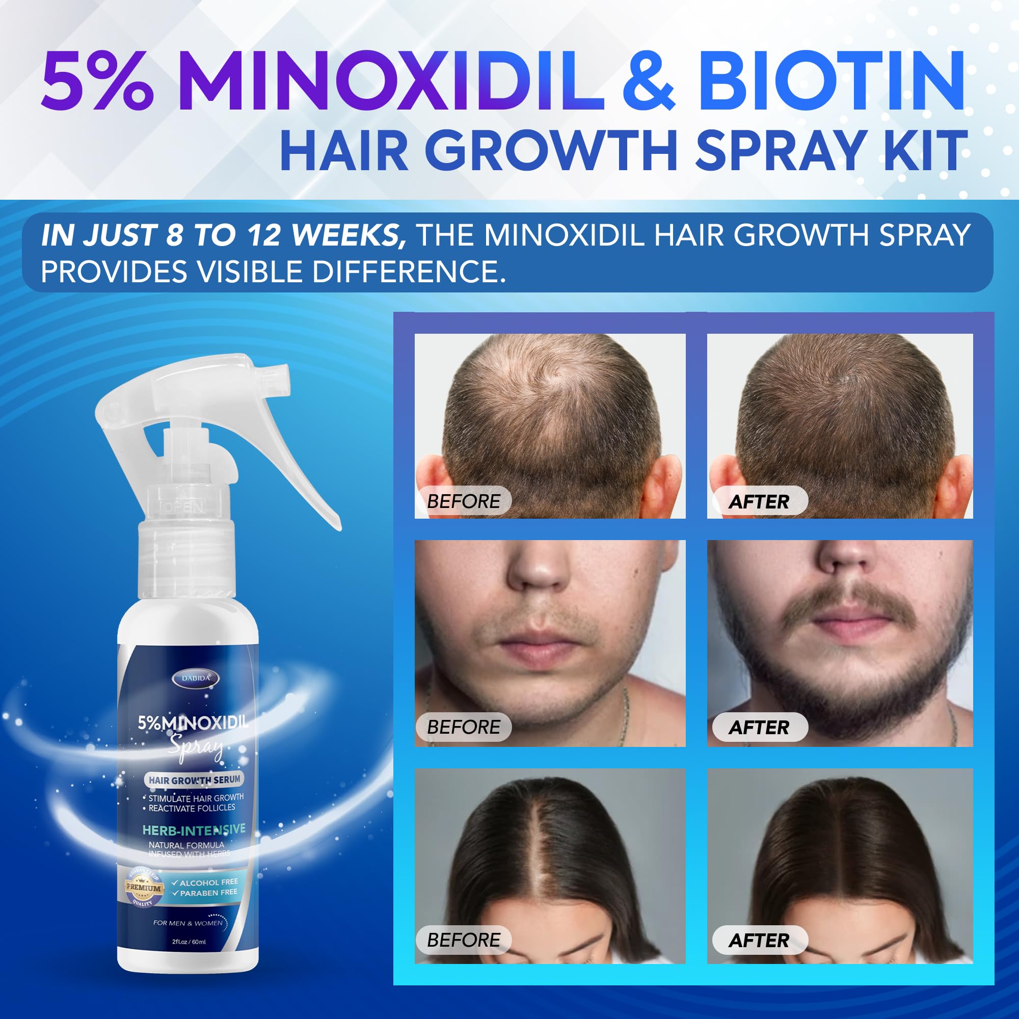 DABIDA Minoxidil spray being applied to the scalp for targeted growth