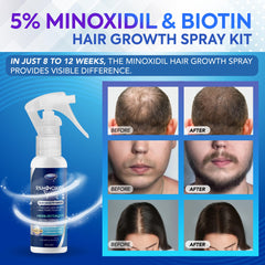 DABIDA Minoxidil spray being applied to the scalp for targeted growth