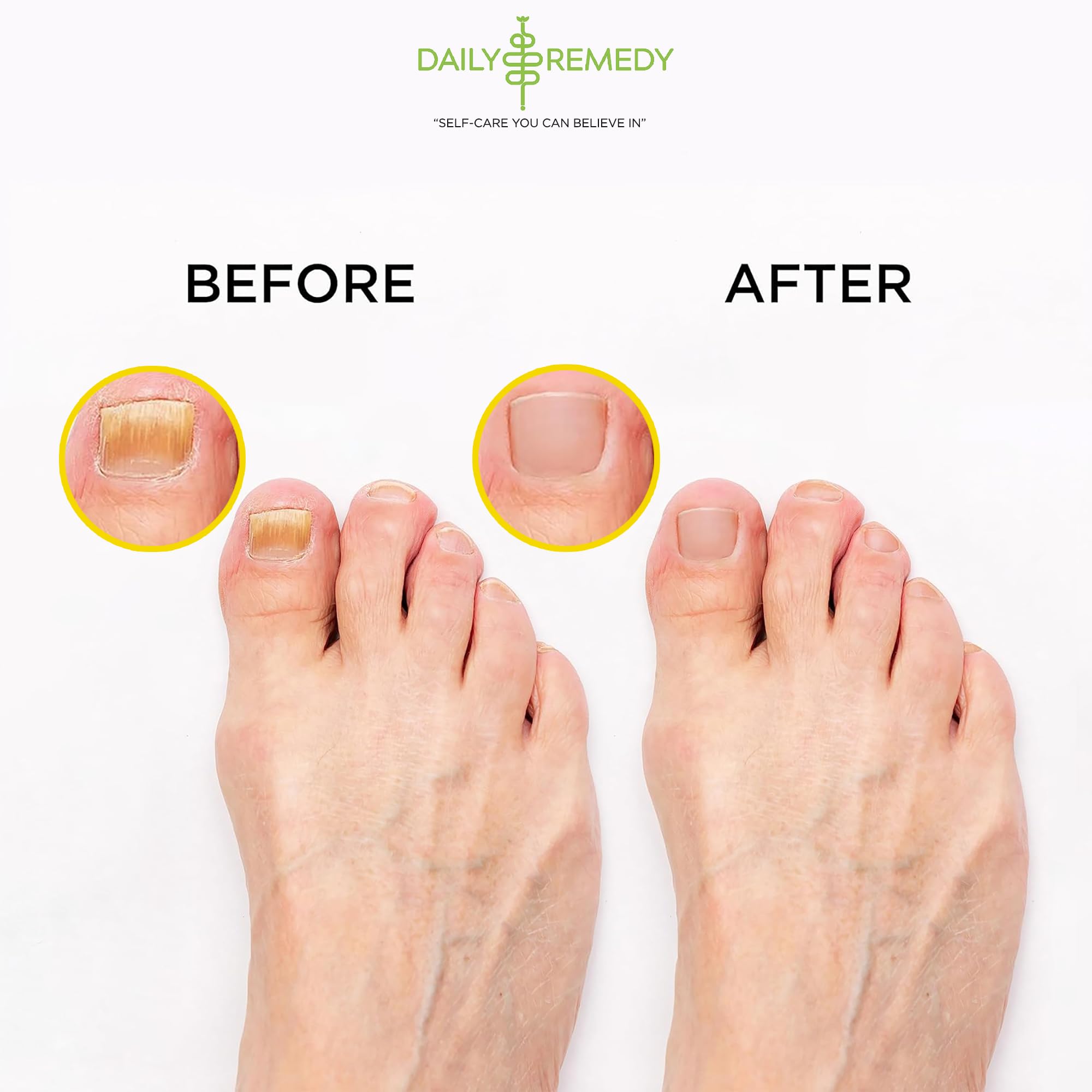 Pouring Daily Remedy foot soak into a basin for a warm soak.