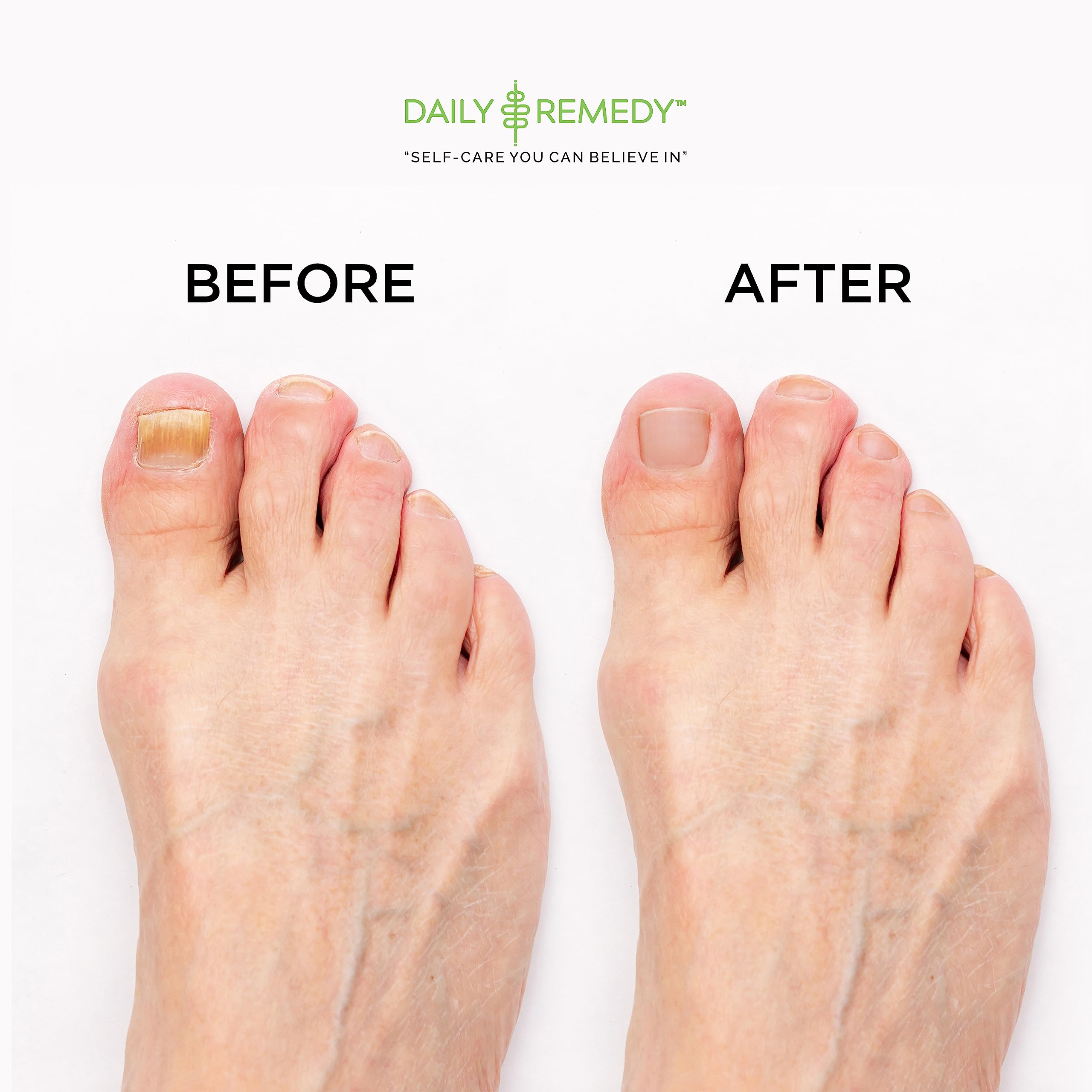 Daily Remedy Ingredients sea salt blend showcases natural power for soothing feet.