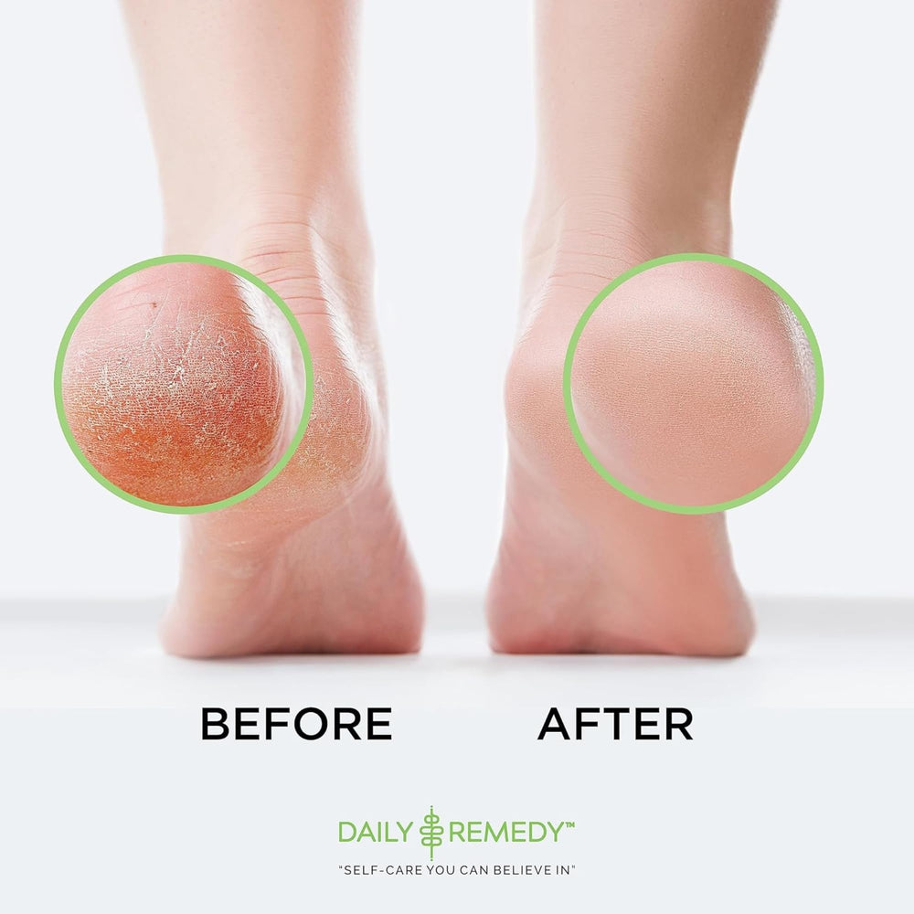Daily Remedy Pieds Douceur Hydratation, pieds plus souples et hydratés.
