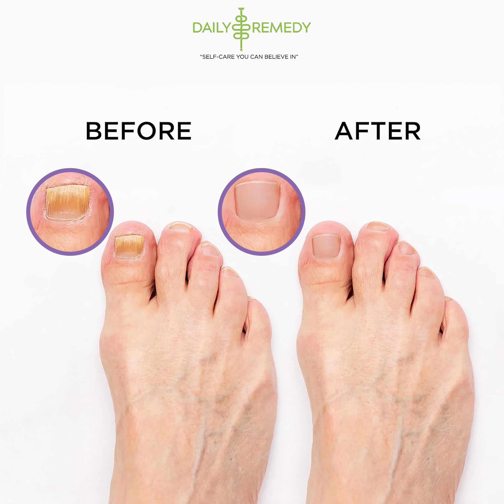 Daily Remedy Rosemary and Camphor Lavender blend for an invigorating foot ritual.