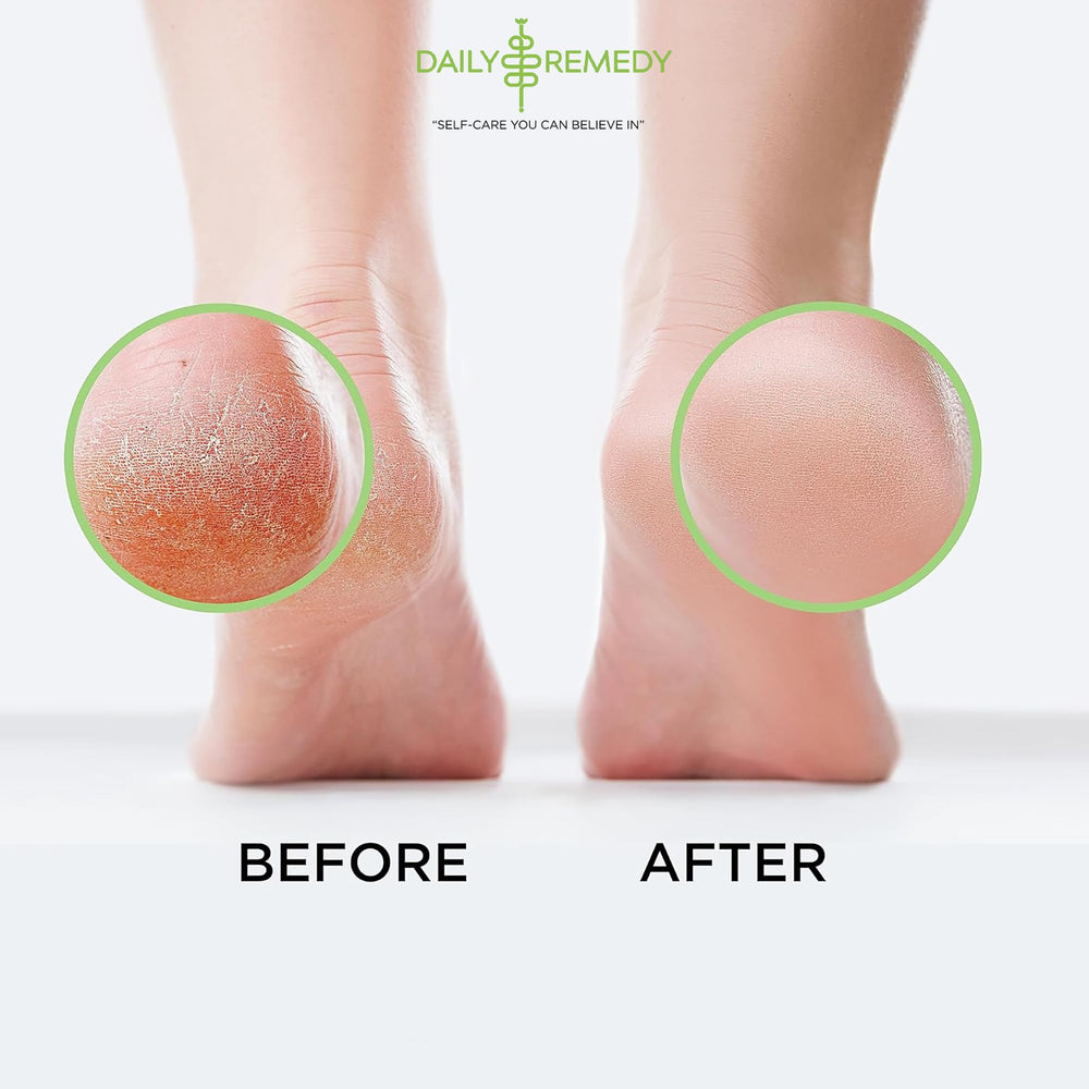 Daily Remedy Foot Soak with Epsom Salt highlighting ingredient blend benefits.