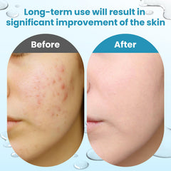 Dalin Glycolic Pads jar packaging showing 60 pads for routine use.