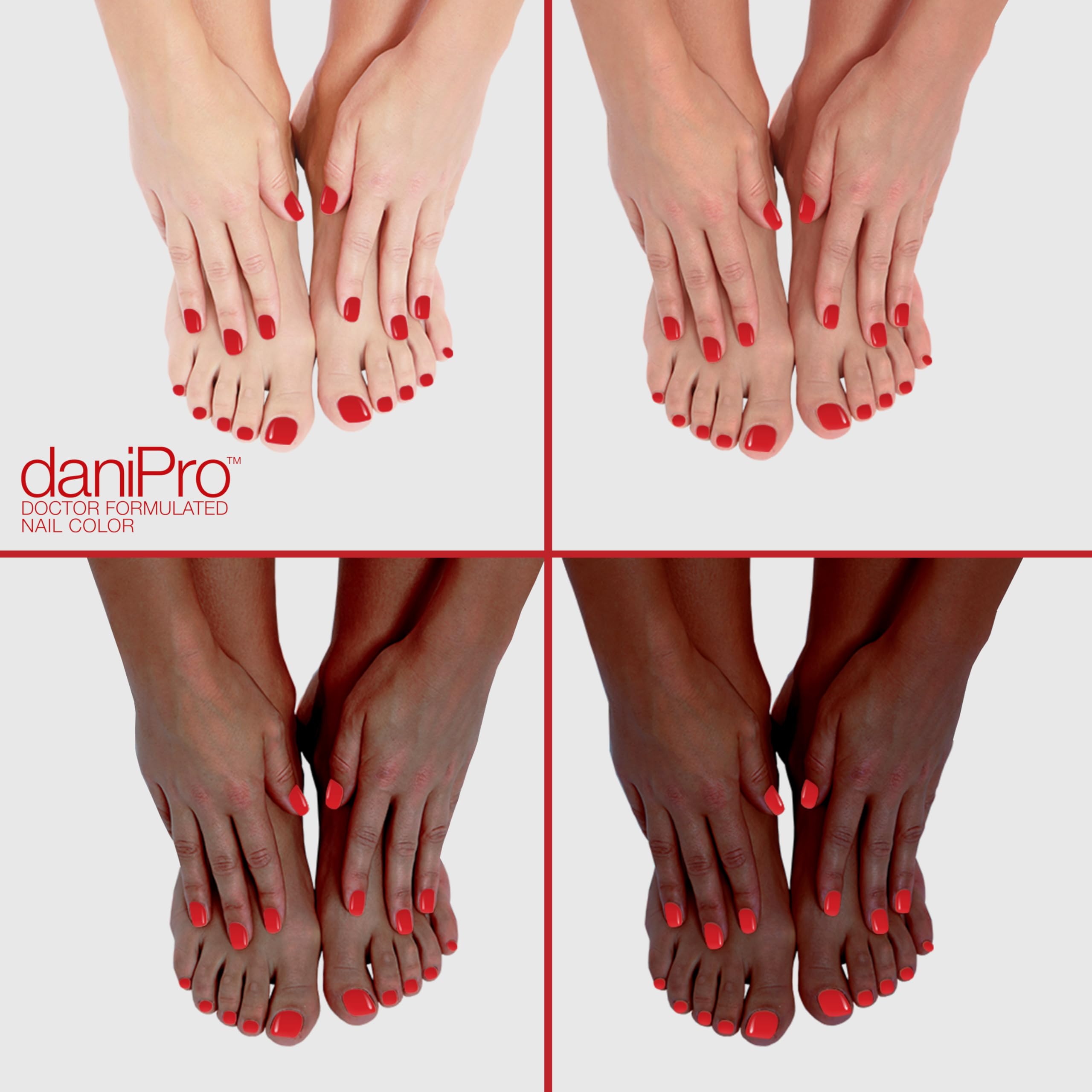 DaniPro First Kiss toenails with bright red polish for summer sandals.