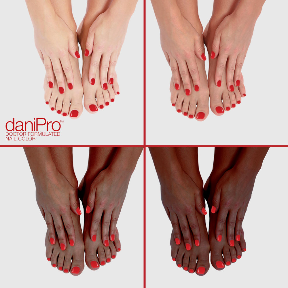 DaniPro First Kiss toenails with bright red polish for summer sandals.