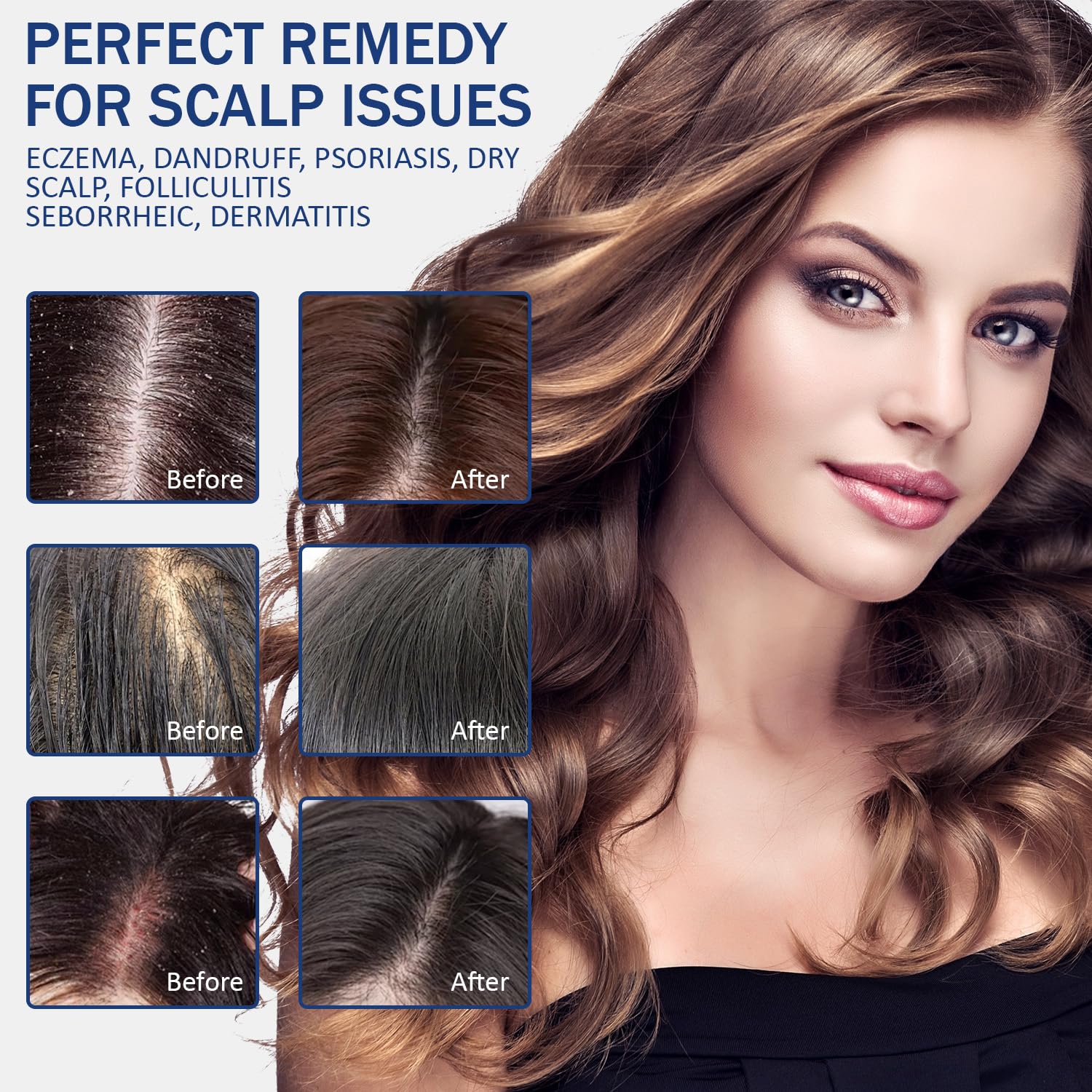 Danliss scalp balance illustration conveys multi-concern care for oil and itch relief.