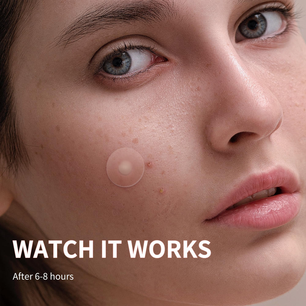 Daolyo Pimple Patches 12mm patch for larger blemishes coverage.