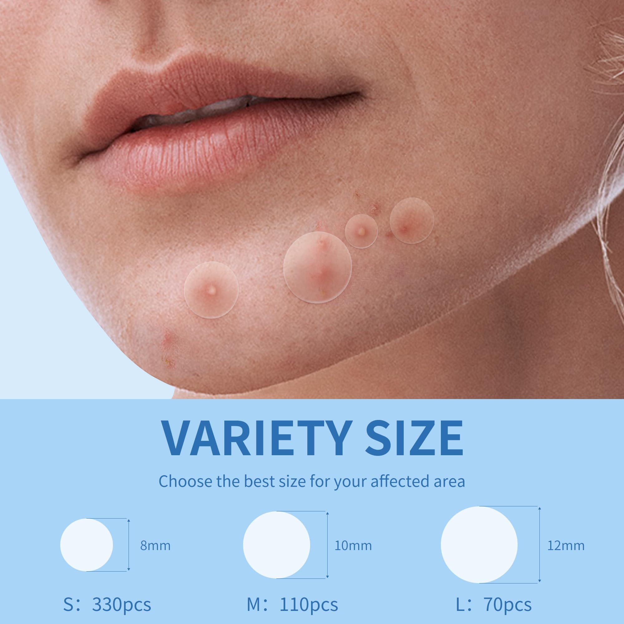 Daolyo Pimple Patches 12mm provides larger patch for bigger zits.