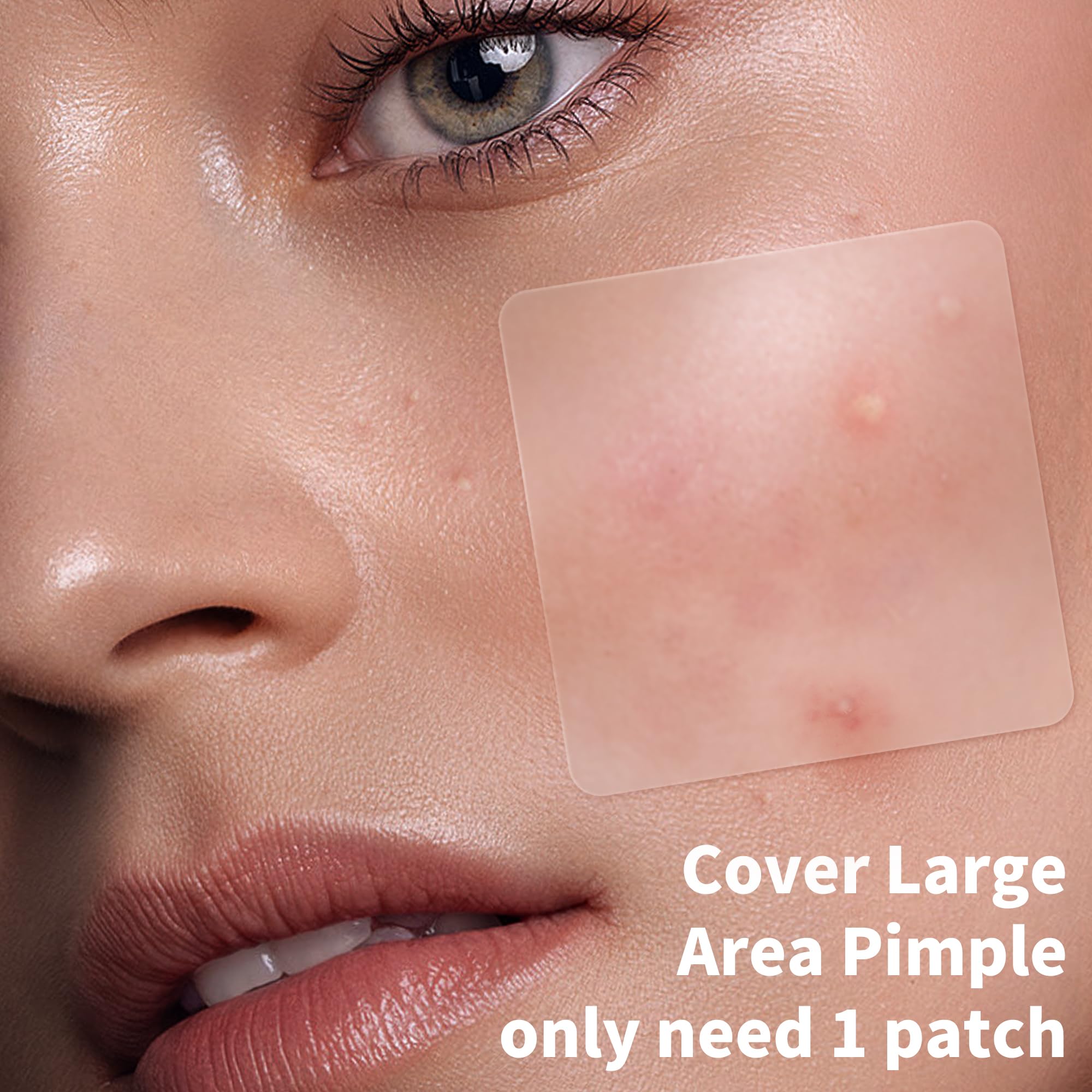 Daolyo round 12mm patch provides larger coverage for mid-size breakouts