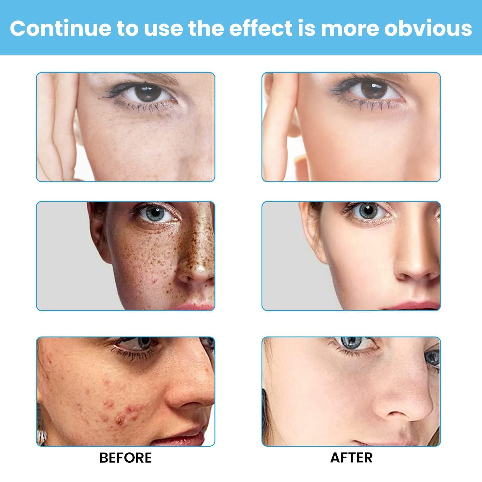 Dark Spot Face Cream bottle suitable for face and body application