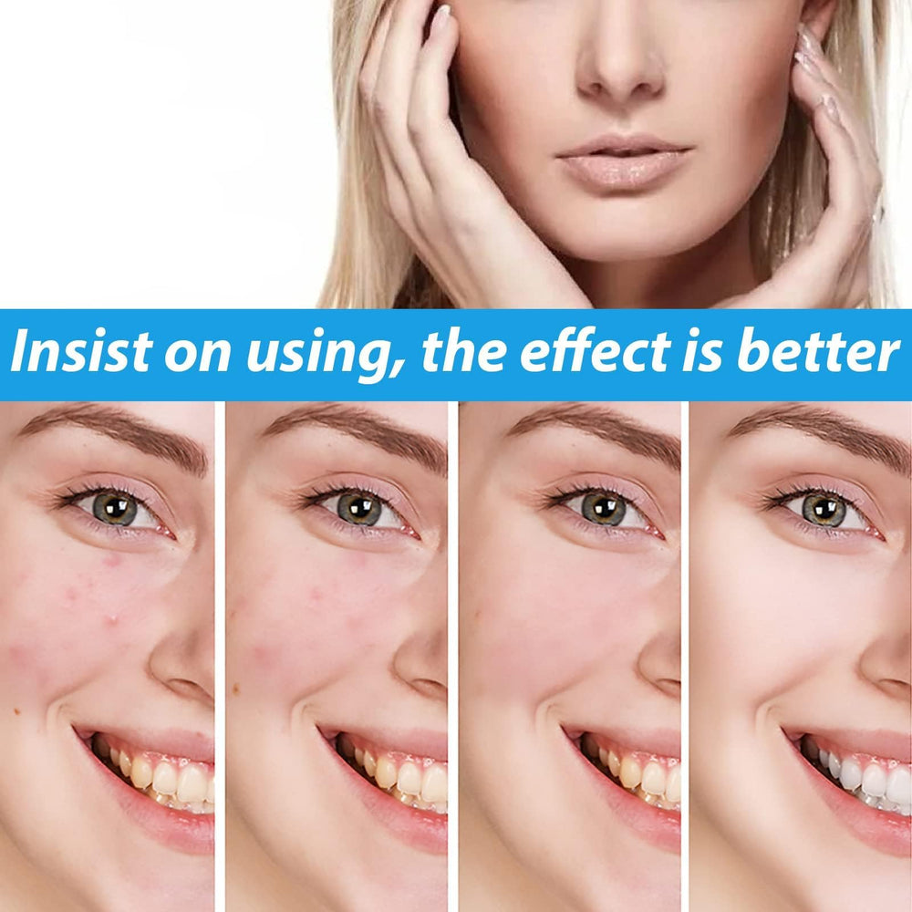 Dark Spot Face Cream on fingertip for precise daily use