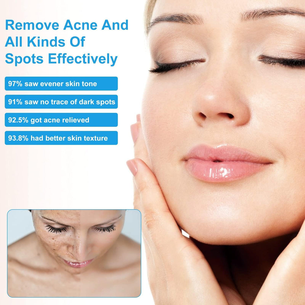 Dark Spot Face Cream on hand for quick daytime application