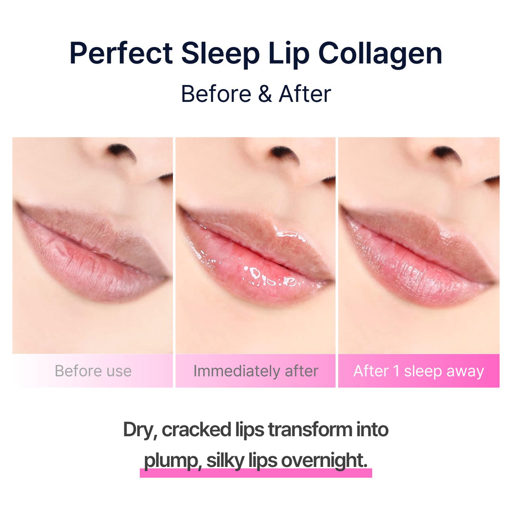 Morning view shows softer, hydrated lips after using the mask.