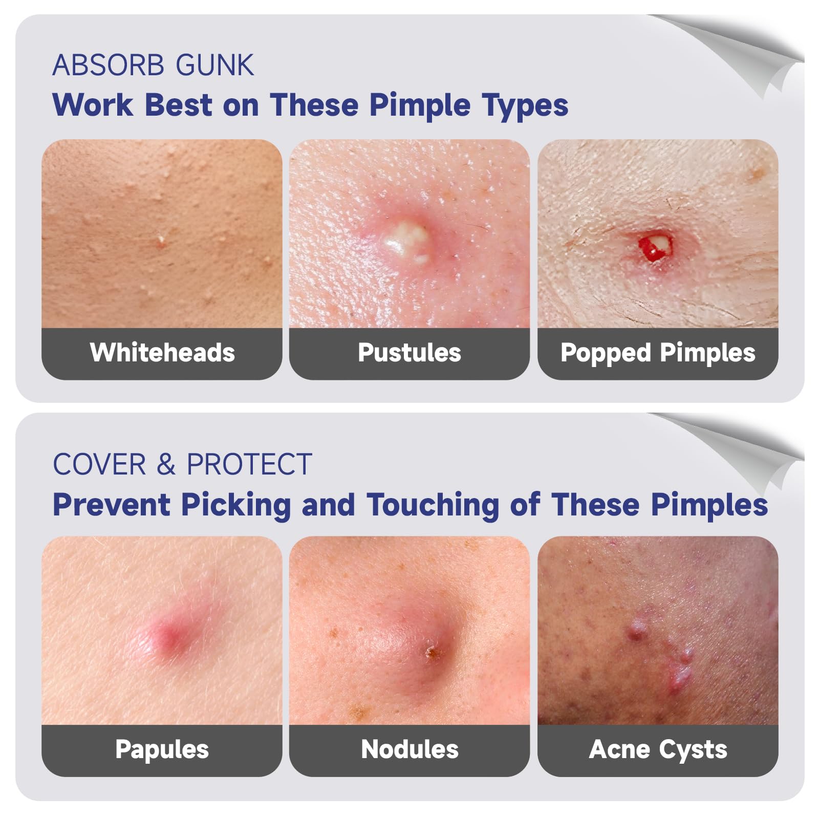 Dazzlook moon patch spot treats breakouts with gentle adhesion.