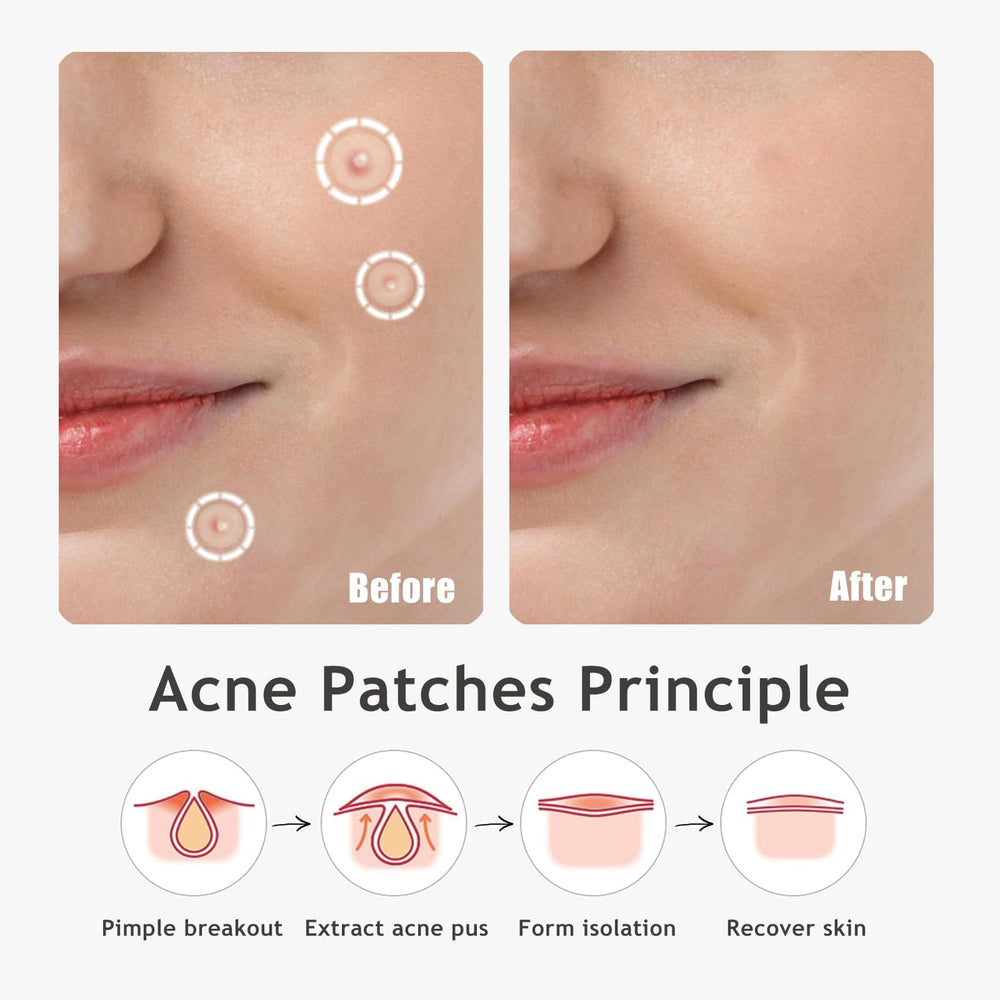 Two sizes with packaging offer flexible blemish coverage.