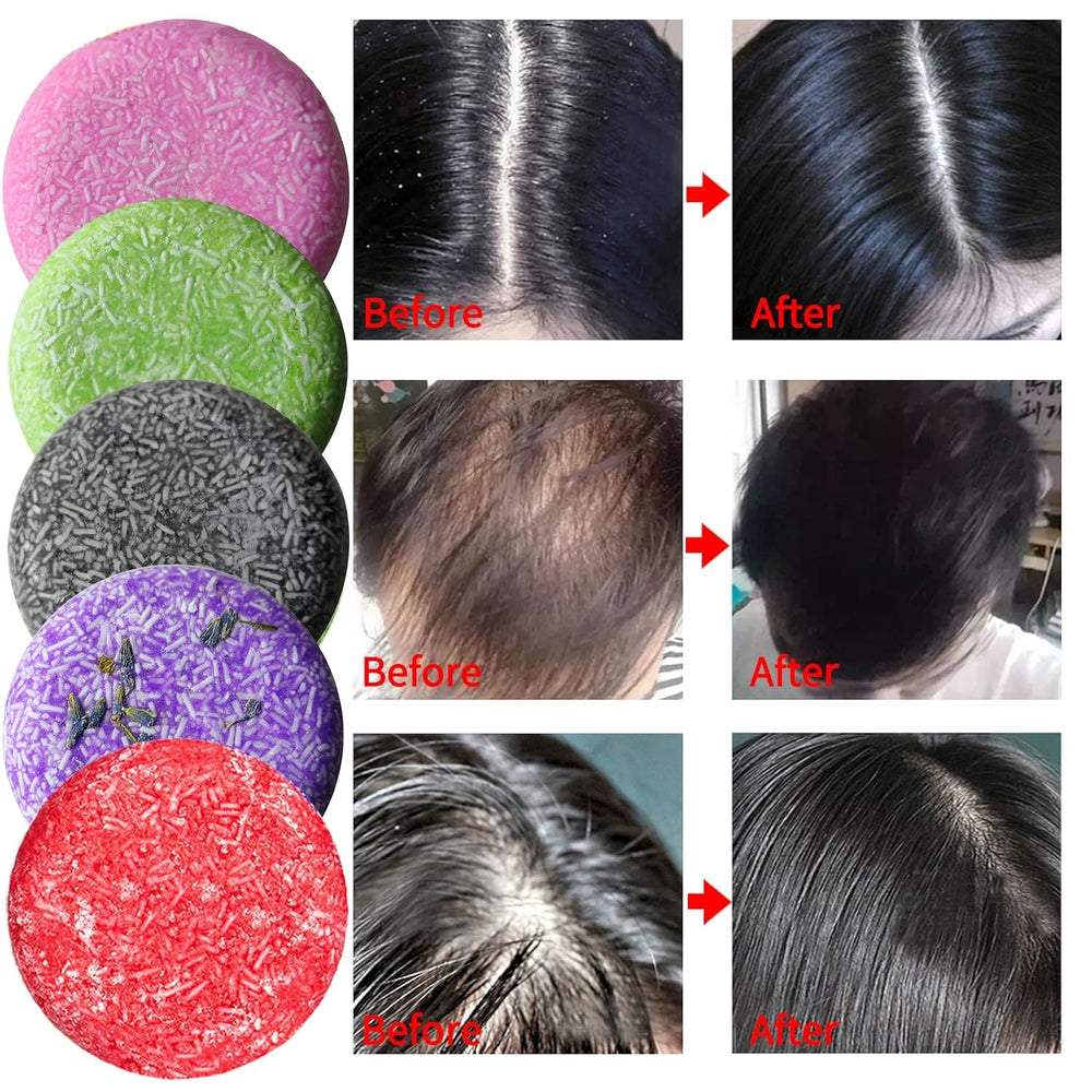 DBEAUTYM rose shampoo bar offers a gentle floral daily scent.