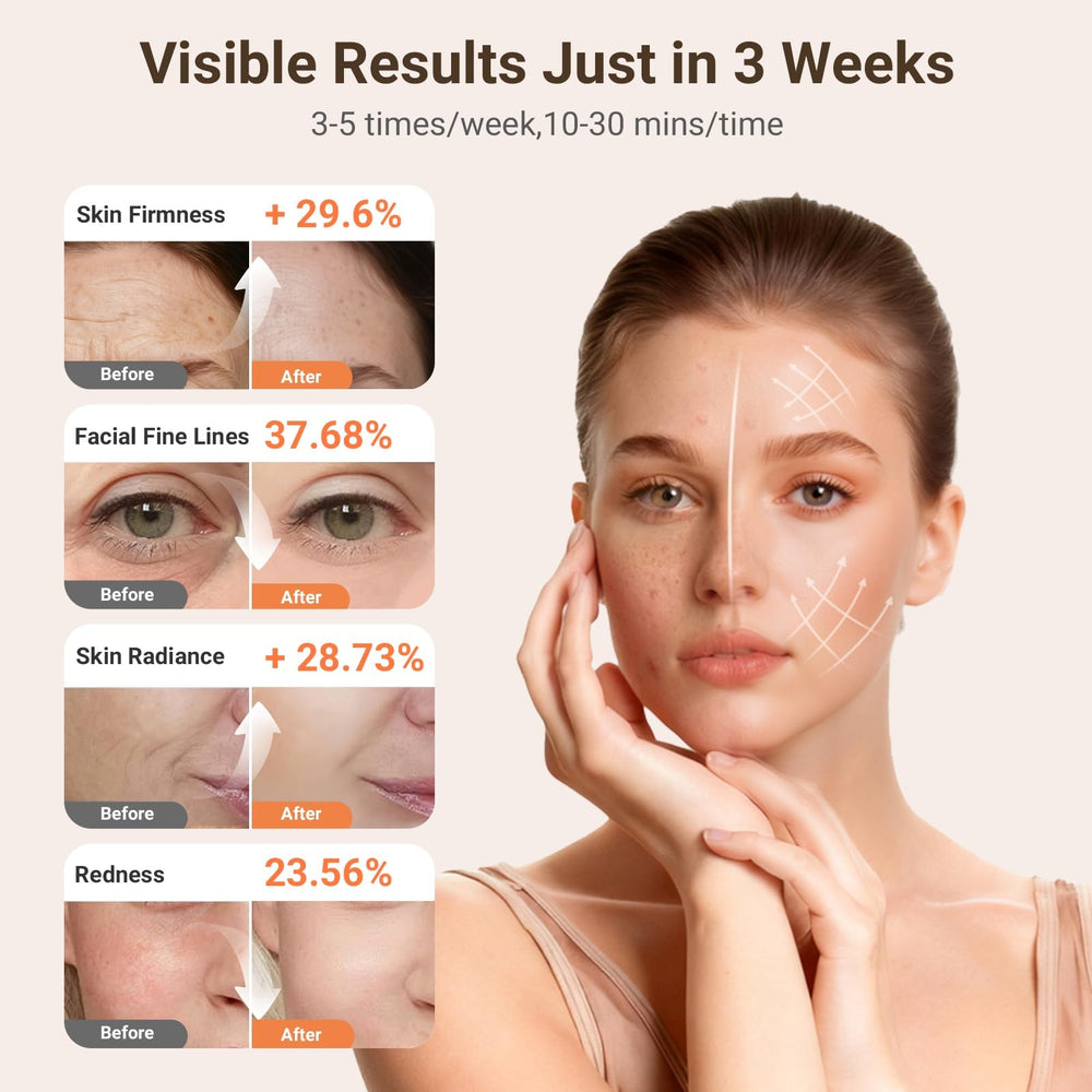 DCBBD full-face-coverage LED mask delivers even light exposure across the entire face.